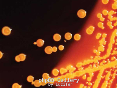 Enterobacteriaceae